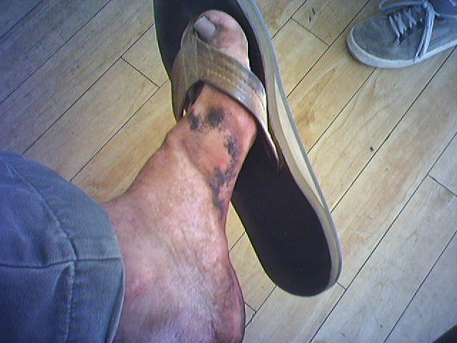 dirty feet